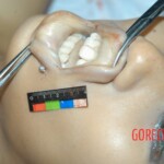 Examination and autopsy of stabbed Chinese woman