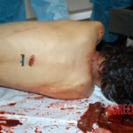 Examination and autopsy of stabbed Chinese woman