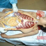 Examination and autopsy of stabbed Chinese woman