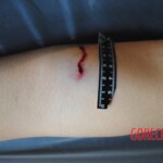 Examination of dead Chinese teen