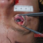 Examination of dead Chinese woman