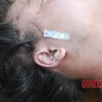 Examination of dead Chinese woman