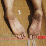 Examination of dead Chinese woman