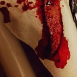 Hardcore self-harm collection