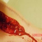 Hardcore self-harm collection