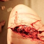 Hardcore self-harm collection