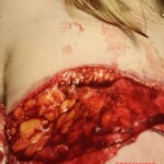 Hardcore self-harm collection