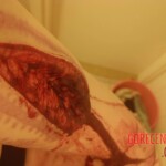 Hardcore self-harm collection