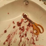 Hardcore self-harm collection