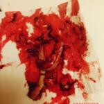 Hardcore self-harm collection