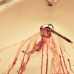 Hardcore self-harm collection