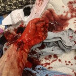 Hardcore self-harm collection