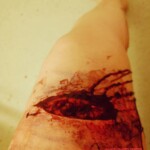 Hardcore self-harm collection