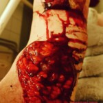 Hardcore self-harm collection