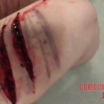 Hardcore self-harm collection