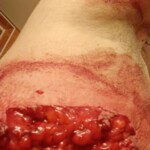 Hardcore self-harm collection