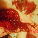 Hardcore self-harm collection