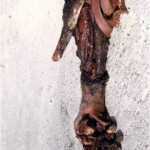 Russian soldier who stepped on mine in Afghanistan