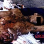 Russian soldier who stepped on mine in Afghanistan