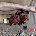 Russian soldier who stepped on mine in Afghanistan