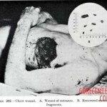 Victim of World War II