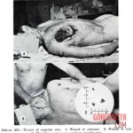 Victim of World War II