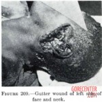 Victim of World War II