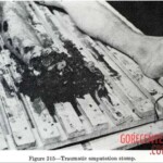 Victim of World War II