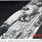 Victim of World War II