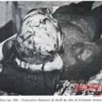 Victim of World War II