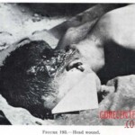 Victim of World War II