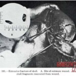 Victim of World War II