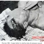 Victim of World War II