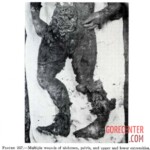 Victim of World War II