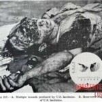 Victim of World War II