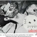 Victim of World War II