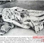 Victim of World War II