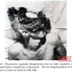 Victim of World War II