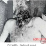 Victim of World War II