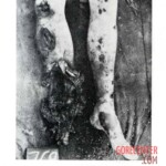 Victim of World War II