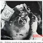 Victim of World War II