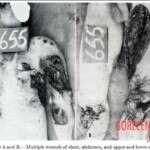 Victim of World War II