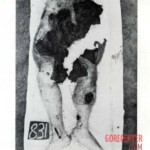 Victim of World War II