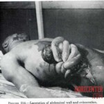 Victim of World War II