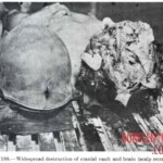 Victim of World War II