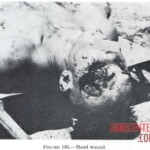 Victim of World War II