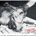 Victim of World War II