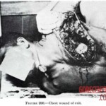 Victim of World War II