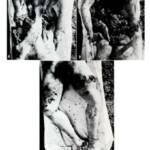 Victim of World War II