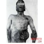 Victim of World War II